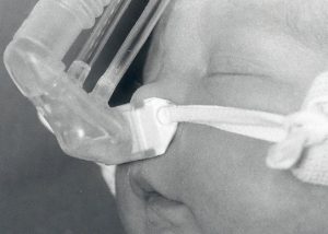 First commercial CPAP system produced by EME in 1990.